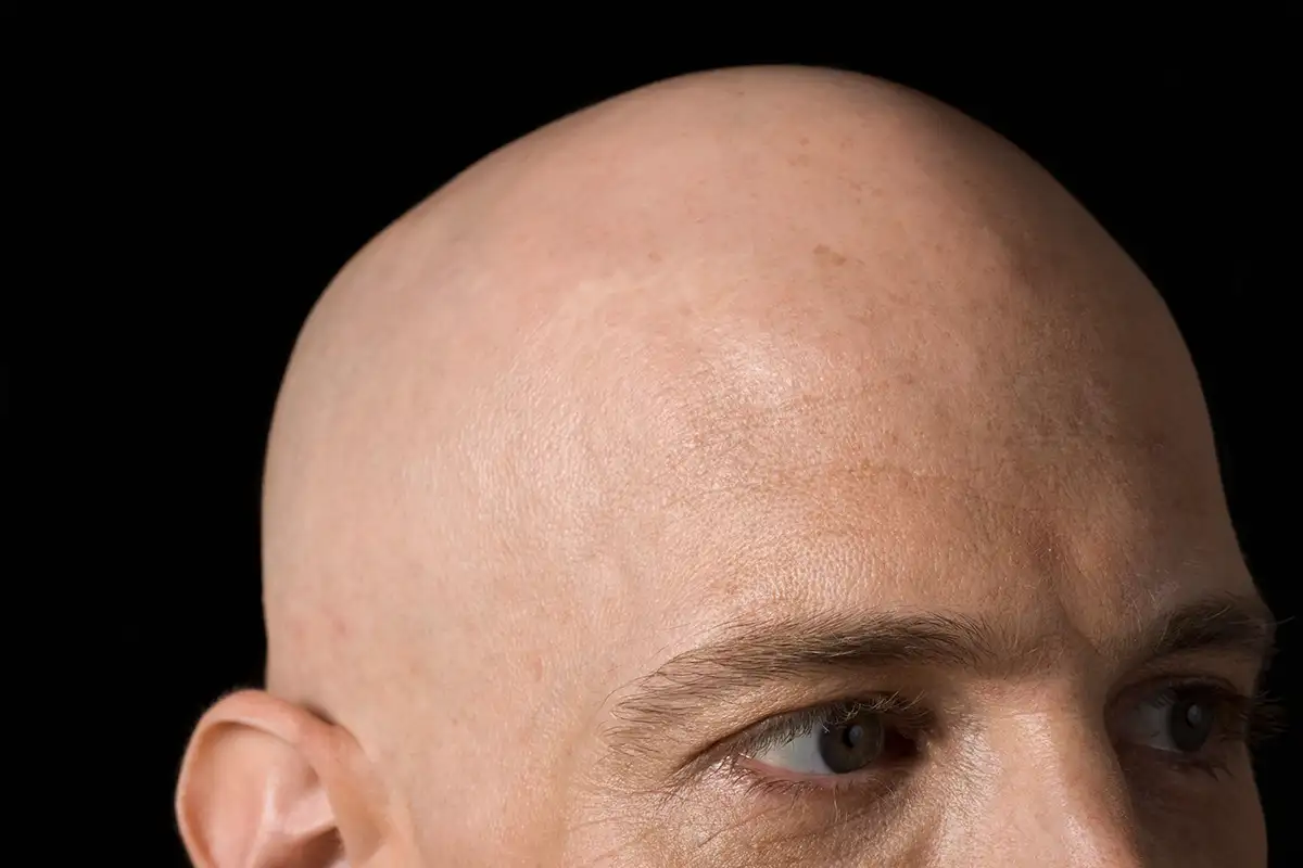 THE BEST BALDS OF ALL TIME
