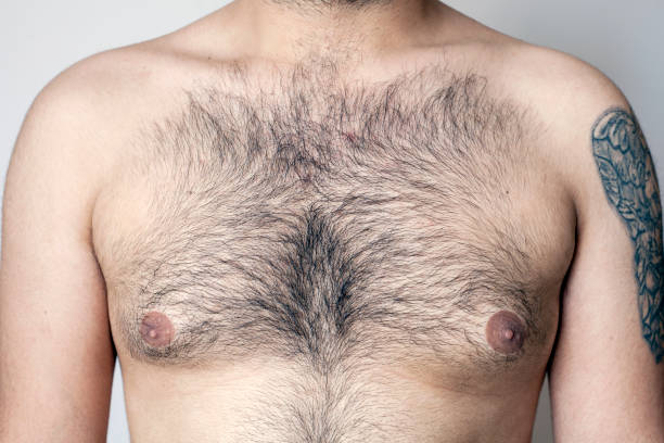 Which of these men looks best with chest hair?